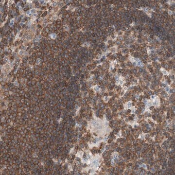 Anti-SPINK6 antibody produced in rabbit Prestige Antibodies&#174; Powered by Atlas Antibodies, affinity isolated antibody, buffered aqueous glycerol solution