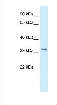 Anti-GNMT antibody produced in rabbit affinity isolated antibody