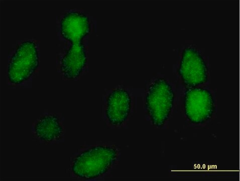 Anti-RPLP0 antibody produced in mouse purified immunoglobulin, buffered aqueous solution