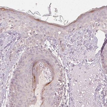 Anti-KPRP antibody produced in rabbit Prestige Antibodies&#174; Powered by Atlas Antibodies, affinity isolated antibody, buffered aqueous glycerol solution