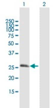 Anti-RGS20 antibody produced in mouse purified immunoglobulin, buffered aqueous solution