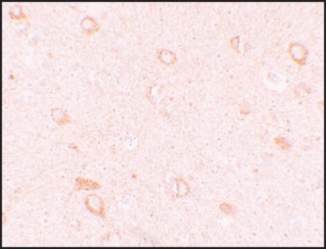 Anti-CIITA antibody produced in rabbit affinity isolated antibody