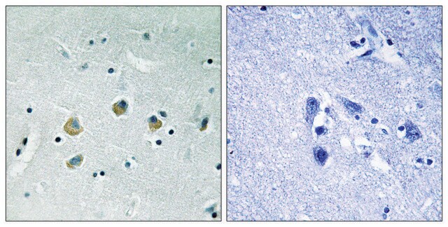 Anti-phospho-MAP3K8 (pSer400) antibody produced in rabbit affinity isolated antibody
