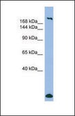 Anti-MYH1, (N-terminal) antibody produced in rabbit affinity isolated antibody