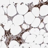 Anti-TFRC antibody produced in rabbit Prestige Antibodies&#174; Powered by Atlas Antibodies, affinity isolated antibody, buffered aqueous glycerol solution