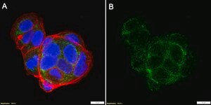 Anti-CPT2 Antibody, clone 1G7 ZooMAb&#174; Rabbit Monoclonal recombinant, expressed in HEK 293 cells