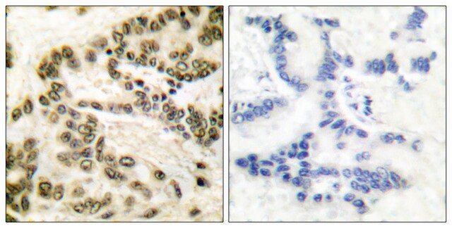 Anti-CREB antibody produced in rabbit affinity isolated antibody