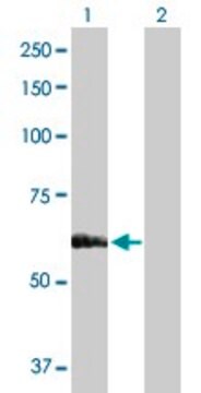 Anti-SARS antibody produced in rabbit purified immunoglobulin, buffered aqueous solution