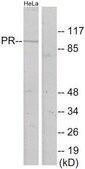 Anti-Progesterone Receptor antibody produced in rabbit affinity isolated antibody