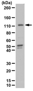 Anti-phospho-STAT2 (Tyr689) Antibody from rabbit, purified by affinity chromatography