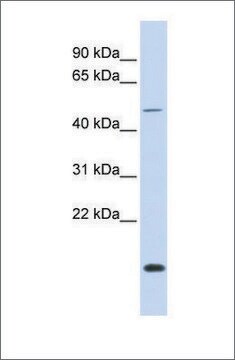 Anti-FOXN3 antibody produced in rabbit affinity isolated antibody