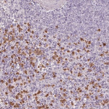 Anti-BIK antibody produced in rabbit Prestige Antibodies&#174; Powered by Atlas Antibodies, affinity isolated antibody, buffered aqueous glycerol solution
