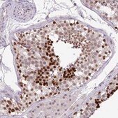 Anti-POLB antibody produced in rabbit Prestige Antibodies&#174; Powered by Atlas Antibodies, affinity isolated antibody, buffered aqueous glycerol solution