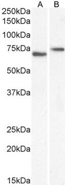 Anti-NOX5 antibody produced in goat affinity isolated antibody, buffered aqueous solution