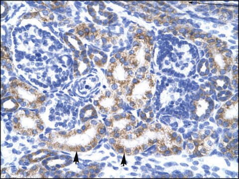 Anti-CREB3L2 antibody produced in rabbit IgG fraction of antiserum