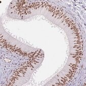 Anti-DDX17 antibody produced in rabbit Prestige Antibodies&#174; Powered by Atlas Antibodies, affinity isolated antibody, buffered aqueous glycerol solution