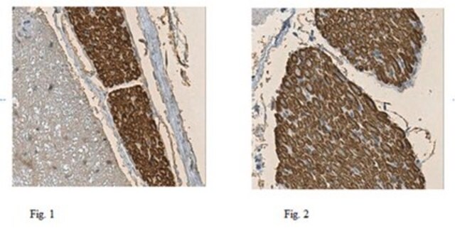 Anti-Myelin Protein P0 Antibody from rabbit, purified by affinity chromatography