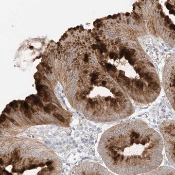 Anti-DGKQ antibody produced in rabbit Prestige Antibodies&#174; Powered by Atlas Antibodies, affinity isolated antibody, buffered aqueous glycerol solution