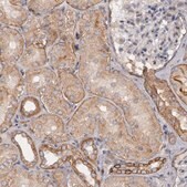 Anti-ERBB2 antibody produced in rabbit Ab1, Prestige Antibodies&#174; Powered by Atlas Antibodies, affinity isolated antibody, buffered aqueous glycerol solution