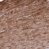 Anti-FABP3 antibody produced in rabbit Prestige Antibodies&#174; Powered by Atlas Antibodies, affinity isolated antibody, buffered aqueous glycerol solution
