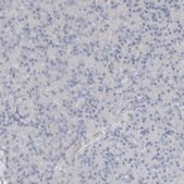 Anti-ARG1 antibody produced in rabbit Prestige Antibodies&#174; Powered by Atlas Antibodies, affinity isolated antibody, buffered aqueous glycerol solution