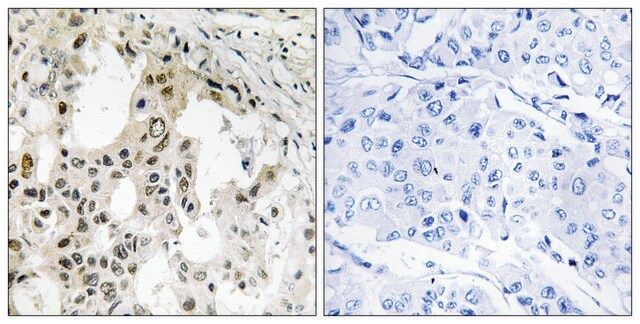 Anti-EIF3D antibody produced in rabbit affinity isolated antibody