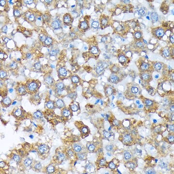 Anti-Cytochrome P450 4A (CYP4A11) Antibody, clone 10D10W7, Rabbit Monoclonal