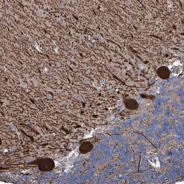 Anti-KIF13A antibody produced in rabbit Prestige Antibodies&#174; Powered by Atlas Antibodies, affinity isolated antibody, buffered aqueous glycerol solution, ab1