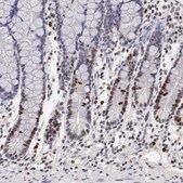 Anti-MKI67 antibody produced in rabbit Ab1, Prestige Antibodies&#174; Powered by Atlas Antibodies, affinity isolated antibody, buffered aqueous glycerol solution
