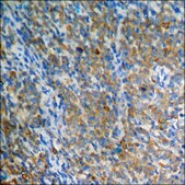 Anti-phospho-CaMK2 (pThr286) antibody produced in rabbit affinity isolated antibody