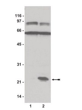 Rap1 Assay Reagent (Ral GDS-RBD, agarose), 650 &#181;g Reagent (Ral GDS-RBD, agarose). A GST-tagged fusion protein, corresponding to amino acids 788-884 of human Ral GDS-Rap binding domain (RBD), for use in Affinity Binding Assays.