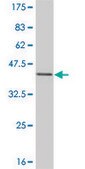 Monoclonal Anti-ESR2 antibody produced in mouse clone 3F3, purified immunoglobulin, buffered aqueous solution