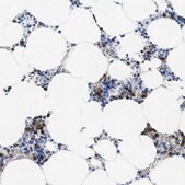 Anti-MMP8 antibody produced in rabbit Prestige Antibodies&#174; Powered by Atlas Antibodies, affinity isolated antibody, buffered aqueous glycerol solution, Ab2