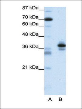 Anti-PITX1 antibody produced in rabbit IgG fraction of antiserum