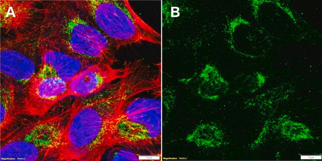 Anti-Mucolipin-1 Antibody, clone 1D9 ZooMAb&#174; Rabbit Monoclonal recombinant, expressed in HEK 293 cells