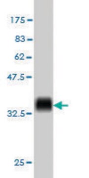 ANTI-KIT antibody produced in mouse clone 1G1, purified immunoglobulin, buffered aqueous solution