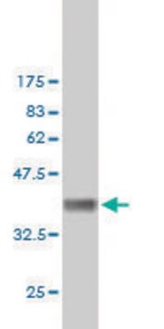 ANTI-FHIT antibody produced in mouse clone 2G3, purified immunoglobulin, buffered aqueous solution