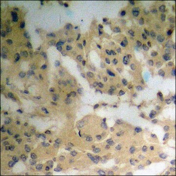 Anti-phospho-Vinculin (pTyr821) antibody produced in rabbit affinity isolated antibody