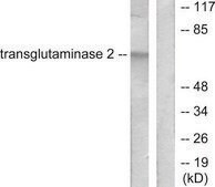 Anti-Transglutaminase 2, N-Terminal antibody produced in rabbit affinity isolated antibody