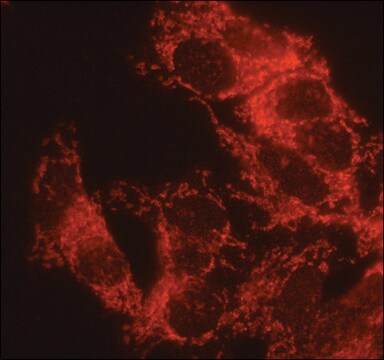 Anti-&#945;1,2-Mannosidase IA antibody produced in rabbit affinity isolated antibody, buffered aqueous solution