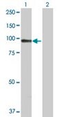 Anti-ACTN1 antibody produced in rabbit purified immunoglobulin, buffered aqueous solution
