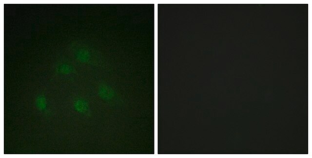 Anti-SMAD1 antibody produced in rabbit affinity isolated antibody