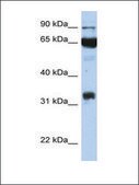 Anti-PTGS1 (AB1) antibody produced in rabbit affinity isolated antibody