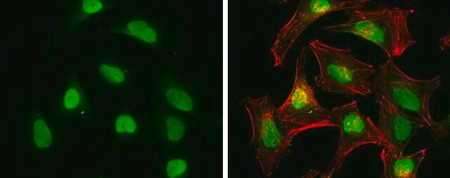 Monoclonal Anti-RBBP8 antibody produced in mouse