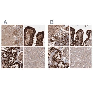 Anti-LRPPRC antibody produced in rabbit Prestige Antibodies&#174; Powered by Atlas Antibodies, affinity isolated antibody, buffered aqueous glycerol solution