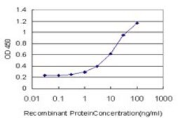 Monoclonal Anti-ESR2 antibody produced in mouse clone 3F3, purified immunoglobulin, buffered aqueous solution
