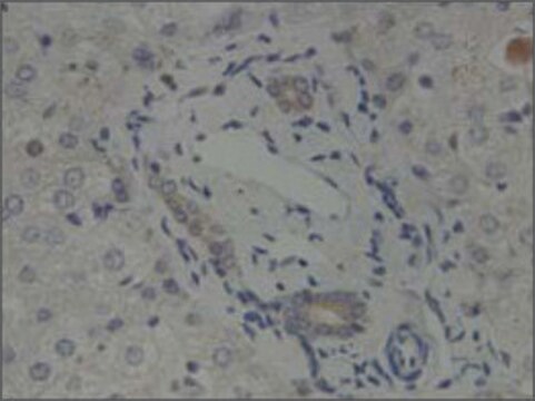 Anti-GLIS2 antibody produced in rabbit affinity isolated antibody