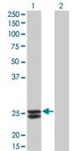 Monoclonal Anti-PRL, (C-terminal) antibody produced in mouse clone 1E1, purified immunoglobulin, buffered aqueous solution