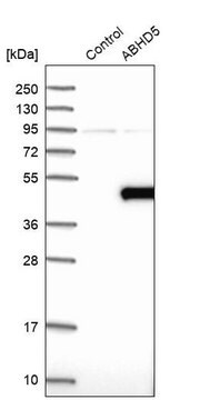 Anti-ABHD5 antibody produced in rabbit Prestige Antibodies&#174; Powered by Atlas Antibodies, affinity isolated antibody, buffered aqueous glycerol solution