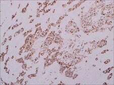 SDHB (EP288) Rabbit Monoclonal Primary Antibody